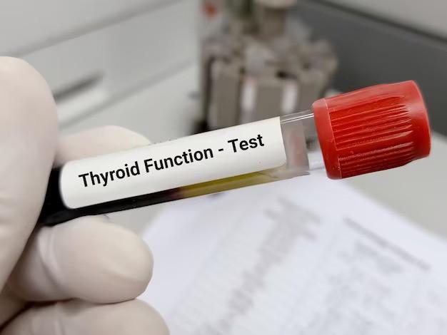 Why You Need a Thyroid Blood Test?