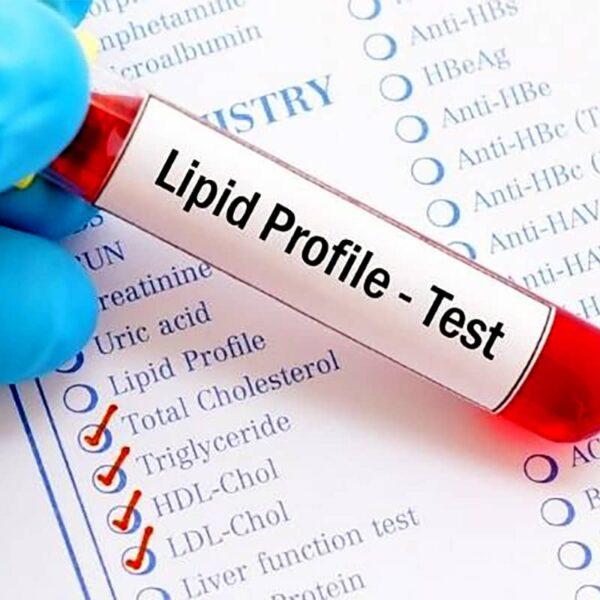 Lipid Profile Test Biocity Healthcare