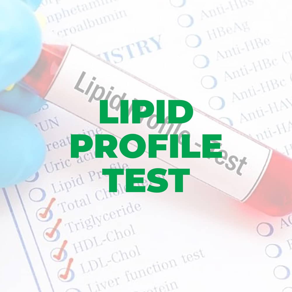 lipid-profile-test-biocity-healthcare