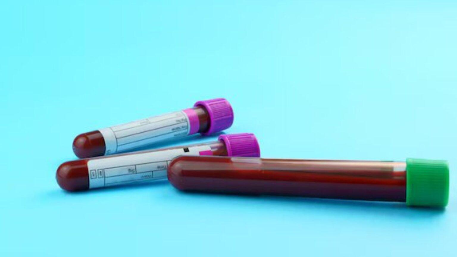 Blood Sample Collection: Process and Health Insights